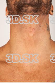 Neck texture of Ron 0001